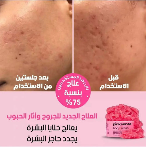 pinksense® لعلاج أثار و الجروح و حب الشباب